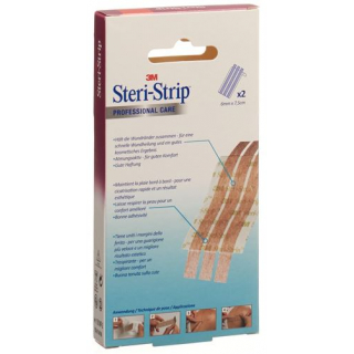 3M STERI STRIP BLENDTONE 6X75M