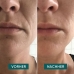 APRICOT wiederv Anti-Falt-Mund Pads Hyalur