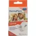 Dermaplast Isopor фиксирующий пластырь 10мX1.25см Vlies Weiss Dispenser Dermaplast Isopor фиксирующий пластырь 10мX1.25см Vlies Weiss Dispenser